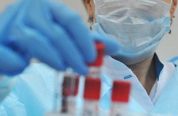 В Краснодарском крае подтверждено 73 новых случая заболевания коронавирусом
