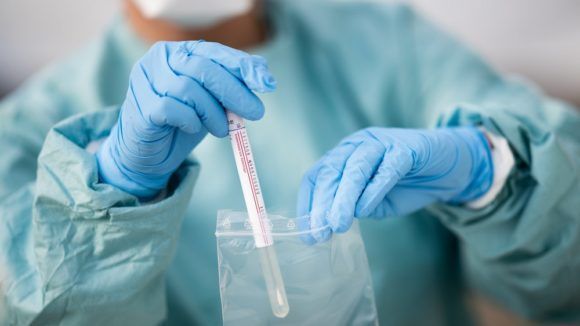 За последние сутки на Кубани выявлено 95 новых случаев коронавируса