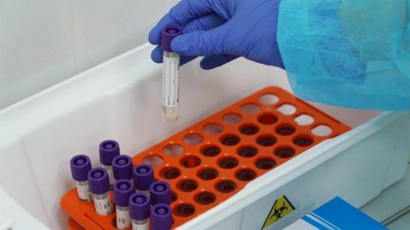 На Кубани подтвердилось 94 новых случая коронавируса