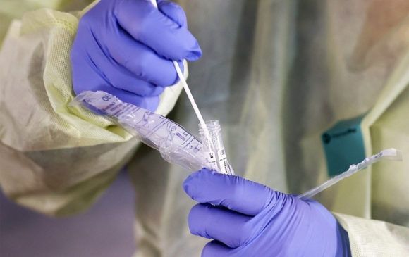 На Кубани подтверждено 85 новых случаев коронавируса