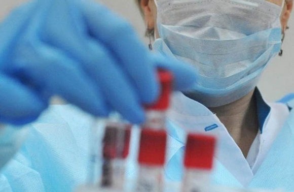 На Кубани умерли три человека с коронавирусом