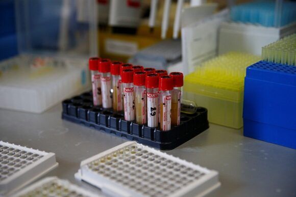 С начала пандемии лаборатории края провели более двух млн тестирований на коронавирус