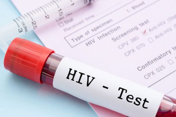 На Кубани пройдет акция по анонимному экспресс-тестированию на ВИЧ-инфекцию