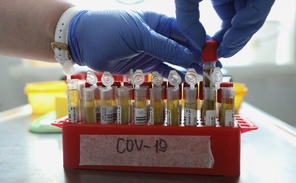 На Кубани зарегистрировано 185 заболевших коронавирусом